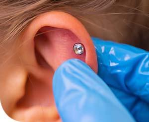 Piercinggel a migrén ellen? 