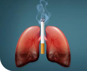 Tüdőrák: főleg a cigaretta a felelős