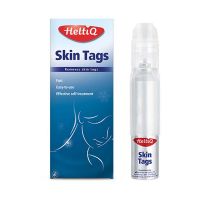 HeltiQ Skin Tags Fibrómák (Lógó Szemölcsök) Kezelésére Krioterápiával
