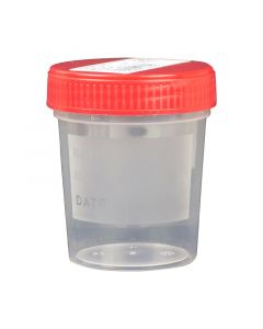Vizeletgyűjtő pohár nem steril fedeles