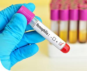 Min múlik a hemofília? 